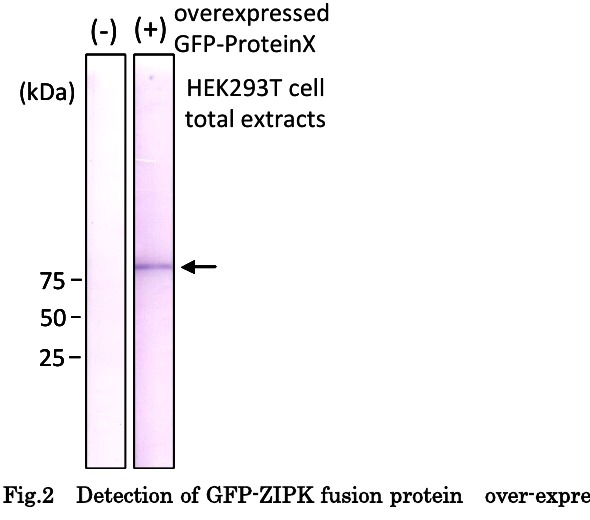 anti-GFP 1A5 웨스턴블롯 (−/+ GFP-ZIPK 과발현)